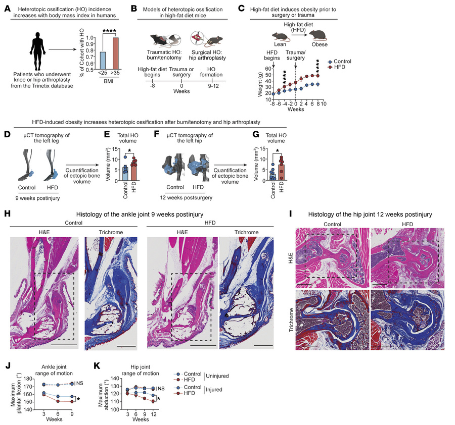 Obesity enhances HO formation and impairs functional recovery after inju...