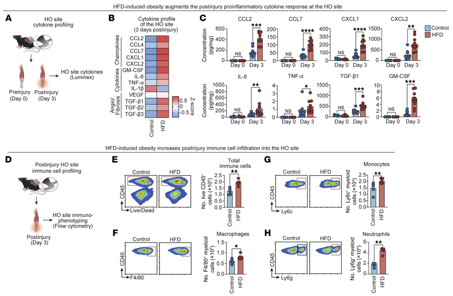 HFD-induced obesity amplifies the injury-induced cytokine response at th...