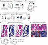 Obesity enhances HO formation and impairs functional recovery after injury.