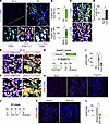 Angpt2/integrin α5β1 signaling is positively associated with pERK expressio