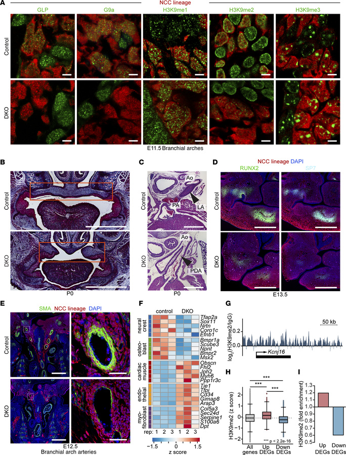 GLP and G9a loss disrupts neural crest differentiation.
(A) E11.5 contro...