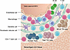Aging-resistant T stem cells drive autoimmune disease.