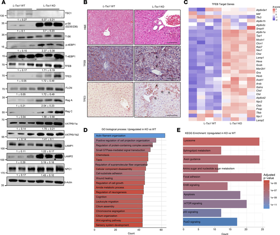 Loss of hepatic TSC1 activates TFEB and increases ductular–fibrotic remo...