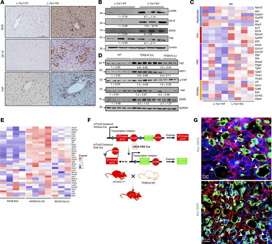 TFEB overexpression in hepatocytes is sufficient to induce hepatocyte tr...