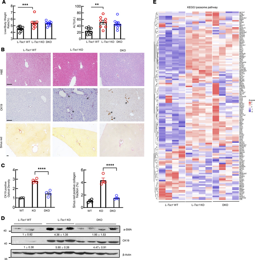 TFEB deletion partially reverses ductular–fibrotic remodeling in TSC1-de...