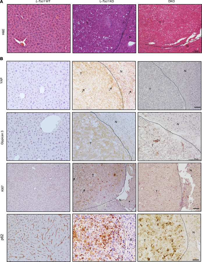 Increased tumor markers in L-Tsc1–deficient mice.
(A and B) Representati...