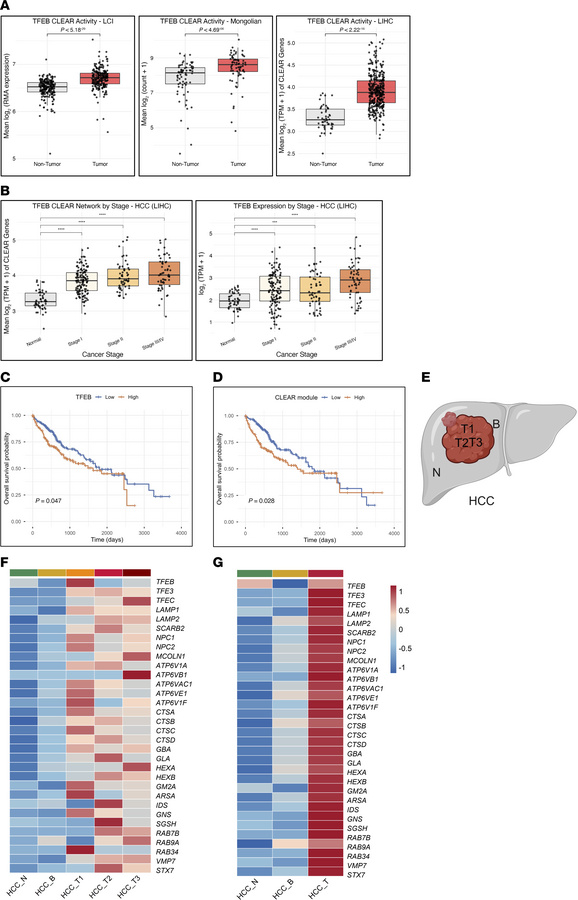 TFEB-CLEAR network activity is elevated in human liver cancer and is ass...