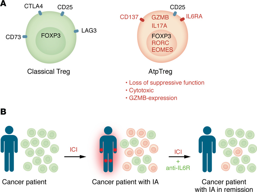 ICI-IA is associated with emergence of atypical Tregs that are sensitive...