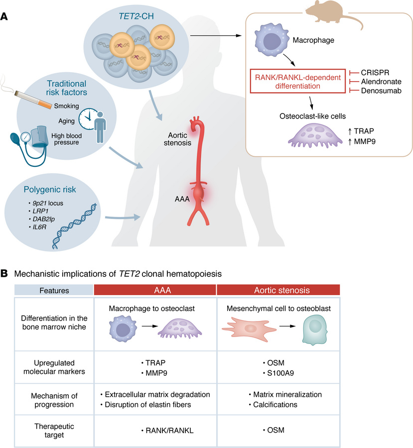 Expanding CH clones promote aneurysm growth via macrophage-to-osteoclast...