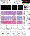 Delivery of a STING inhibitor via LSEC-directed RLTR-liposome ameliorates M