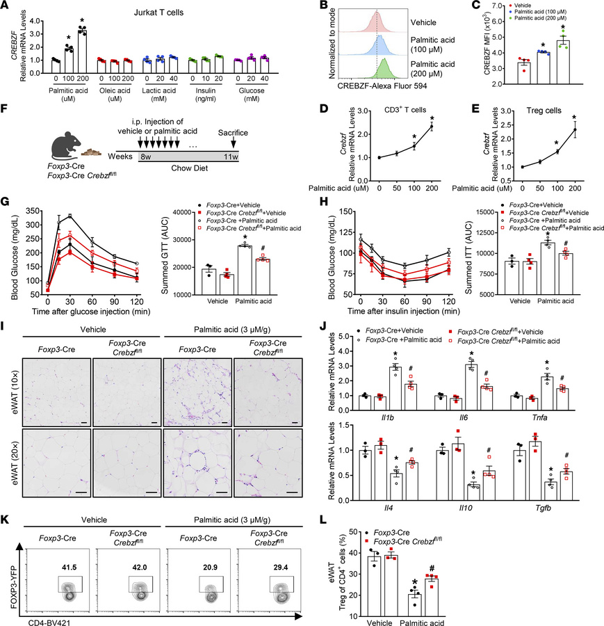 PA impairs Treg-mediated immunosuppression via CREBZF upregulation.
(A–D...