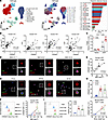 CREBZF is elevated in adipose tissue T cells in humans and mice with obesit