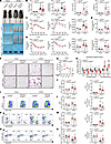 T cell–specific Crebzf deficiency protects against HFHS diet–induced metabo