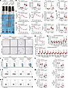 CREBZF in Tregs links eWAT inflammation to systemic metabolic dysfunction d
