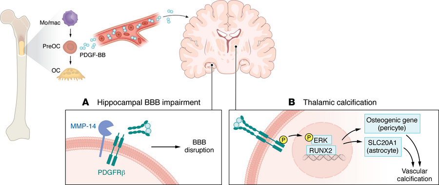 Bone-derived PDGF-BB drives region-specific cerebrovascular pathology.
S...