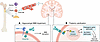 Bone-derived PDGF-BB drives region-specific cerebrovascular pathology.