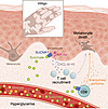 Hyperglycemia exacerbates vitiligo by way of the succinate/SUCNR1 axis.