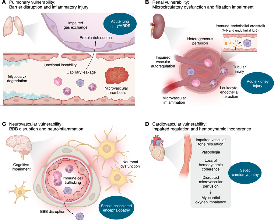 Organ-specific manifestations of endothelial dysfunction in sepsis.
The ...