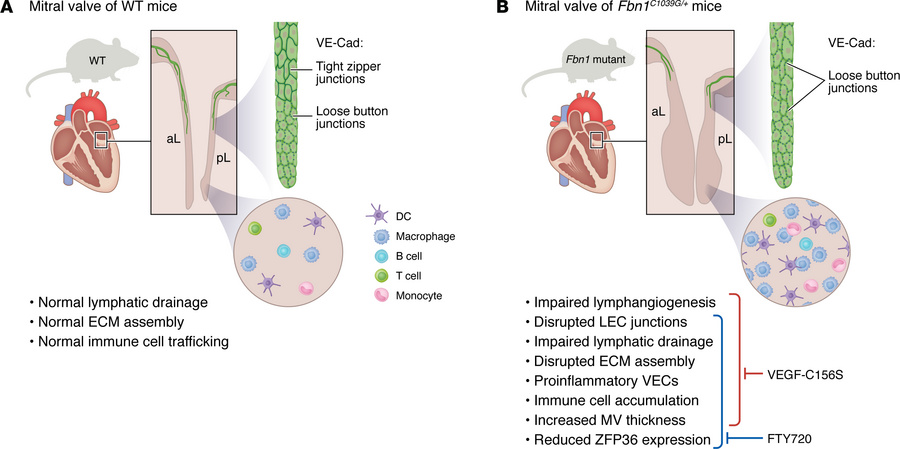 Implicating defective lymphatic vessel development in MFS-associated val...