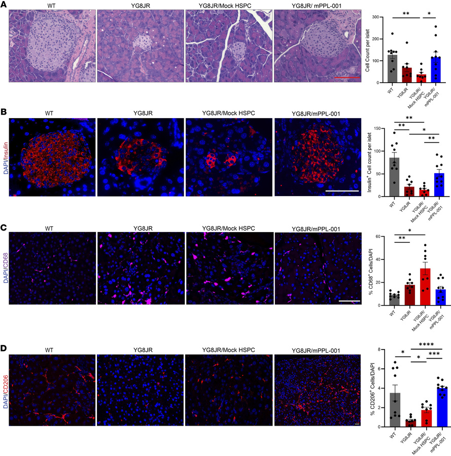 mPPL-001 transplantation preserves insulin-producing β cells of pancreat...