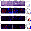 mPPL-001 transplantation preserves insulin-producing β cells of pancreatic