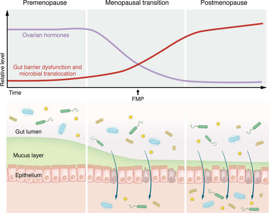 Proposed model linking menopause-related ovarian hormone decline with gu...