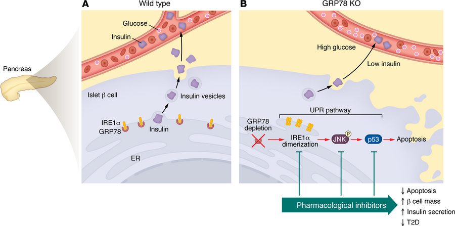 Pharmacological inhibition of the IRE1α-JNK-p53 signaling axis suppresse...