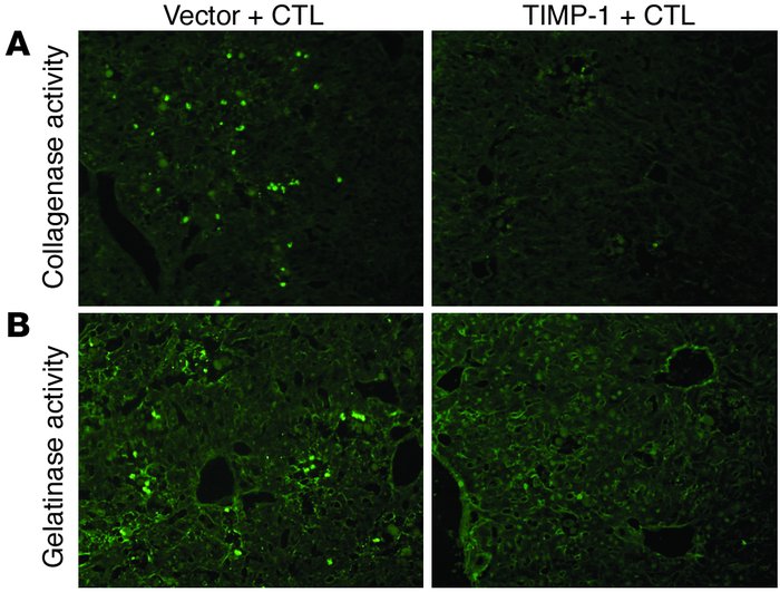 Induction of collagenase and gelatinase activities within the intrahepat...