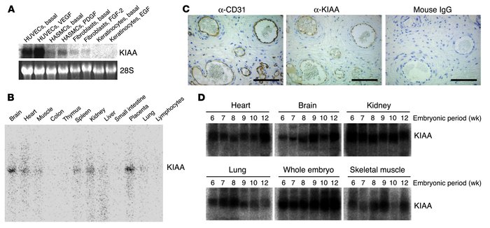 KIAA1036 is preferentially expressed in ECs. (A) Expression of KIAA1036 ...