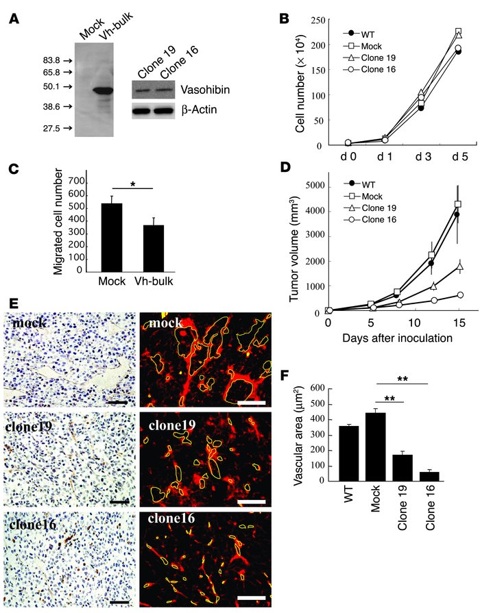 Vasohibin suppresses tumor growth and tumor angiogenesis. (A) The synthe...