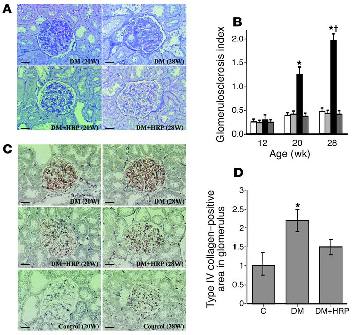 Inhibition of the development of diabetic nephropathy by the HRP of pror...