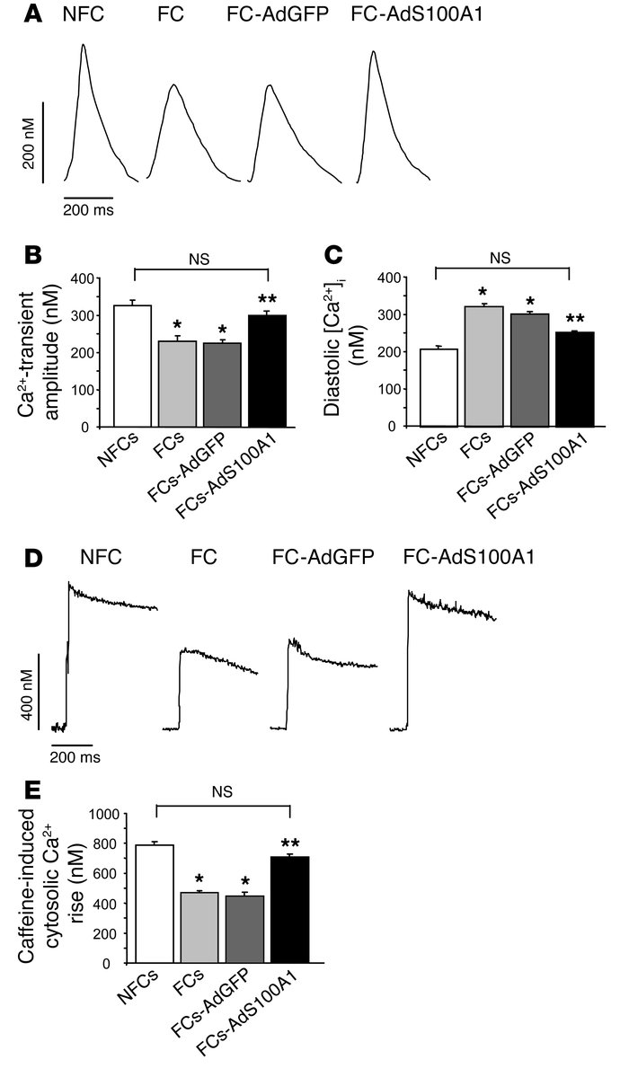 Normalization of Ca2+ transients and SR Ca2+ load after S100A1 gene deli...