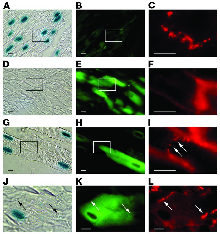 Connexin43 immune reactivity between cells arising from myoblast-cardiom...