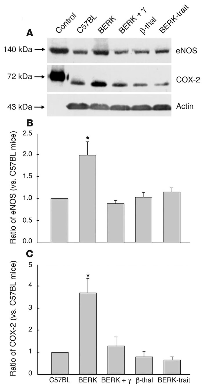 Western blot analysis of cremaster muscle lysates for eNOS and COX-2 in ...