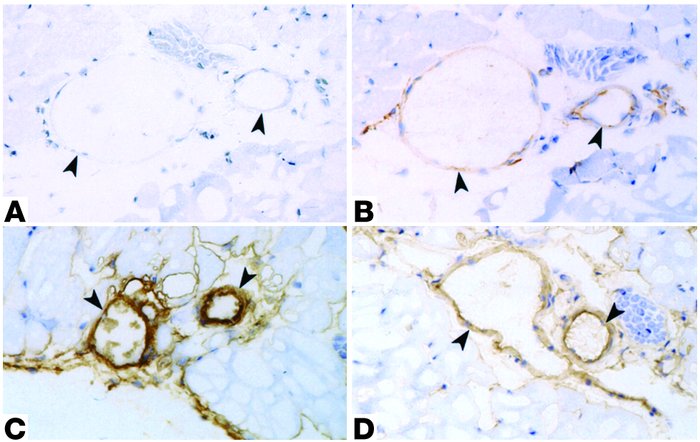 Immunoperoxidase staining for eNOS in the cremaster muscle microvasculat...