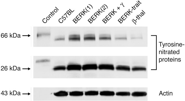 Western blot analysis of cremaster muscle lysates for the expression of ...