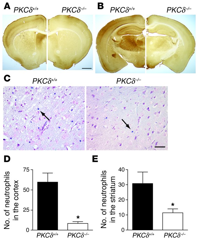 Expression pattern of PKCδ in the brain and extravascular neutrophils af...