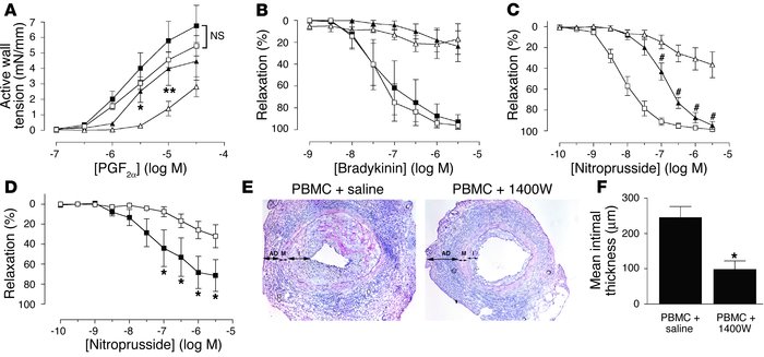 Contribution of iNOS to VSMC dysfunction and graft arteriosclerosis. (A–...