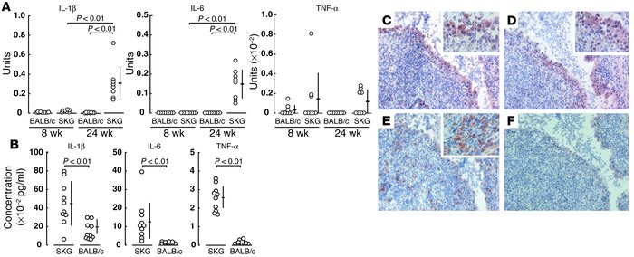 Expression of cytokines at mRNA and protein levels. (A) Quantitative RT-...