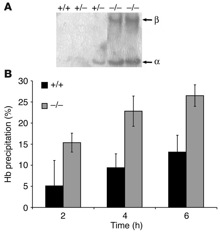 Unstable hemoglobins in AHSP–/– erythrocytes. (A) TAU gel analysis of me...