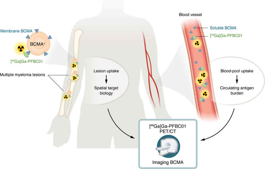BCMA-targeted PET imaging in multiple myeloma.
Gu et al. (7) showed that...