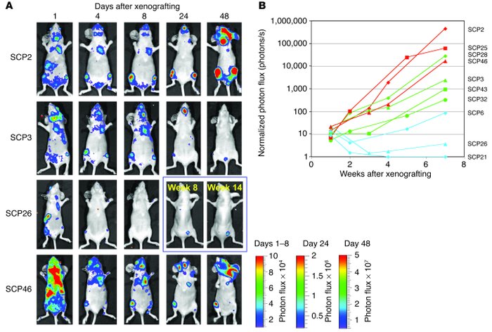 SCPs exhibit different abilities to metastasize to bone. (A and B) Each ...