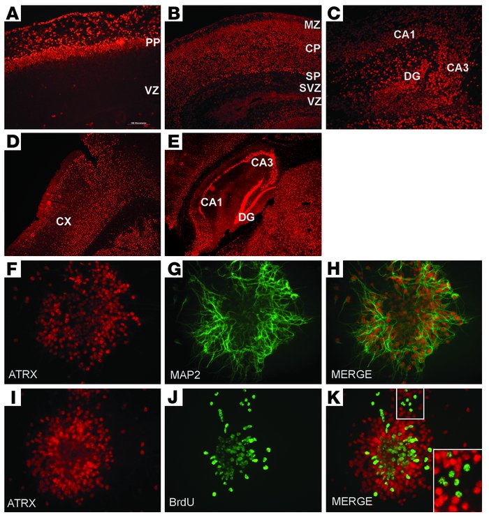 ATRX expression increases in postmitotic neurons. (A–E) Fixed tissue sec...