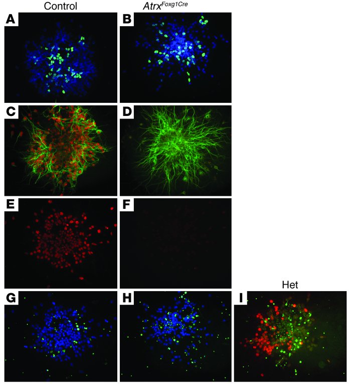 Increased apoptosis but normal proliferation in ATRX-deficient primary c...