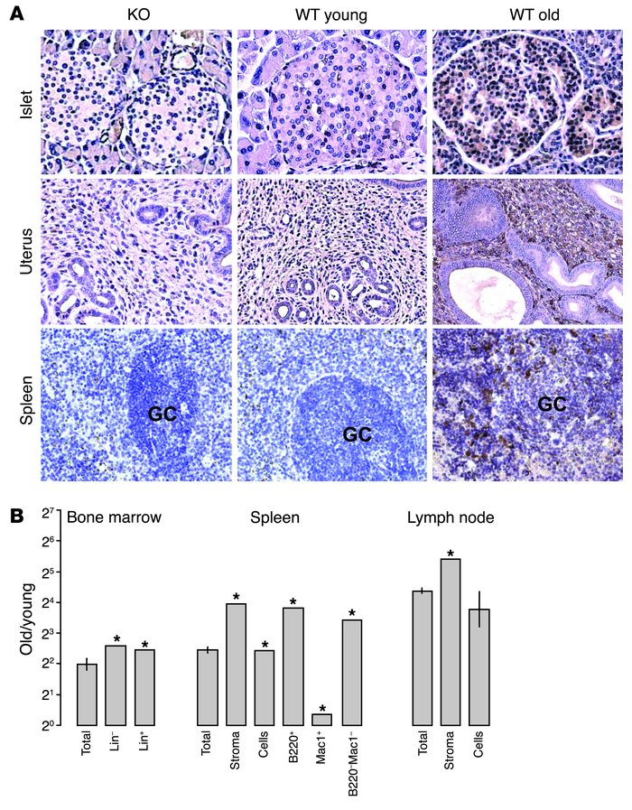 p16INK4a expression in specific compartments by immunohistochemistry and...