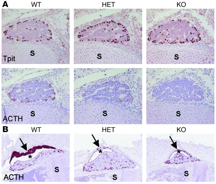 Loss of Ikaros impairs pituitary corticomelanotroph development and ACTH...