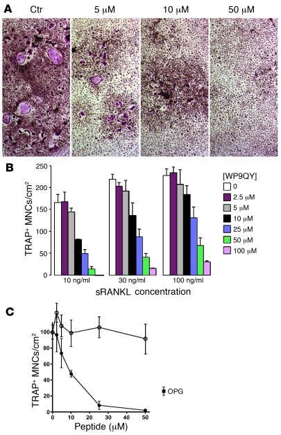 WP9QY inhibits sRANKL-induced osteoclastogenesis and bone resorption in ...