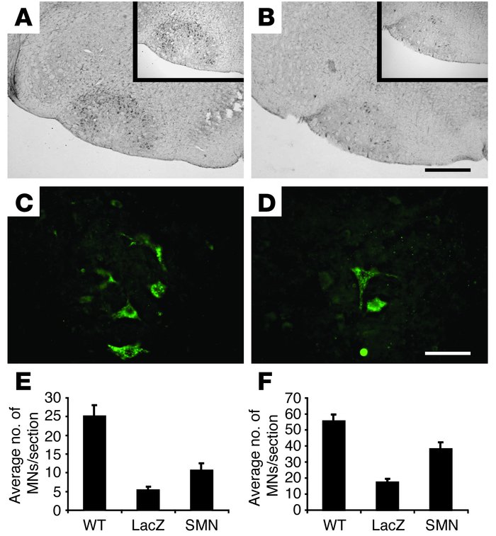 SMN gene replacement protects spinal and brain stem MNs in SMA mice. ChA...