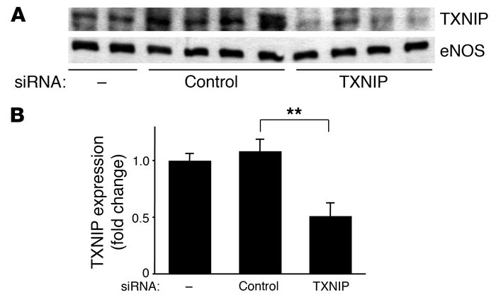 TXNIP protein expression was decreased by siRNA in HUVECs. HUVECs were t...
