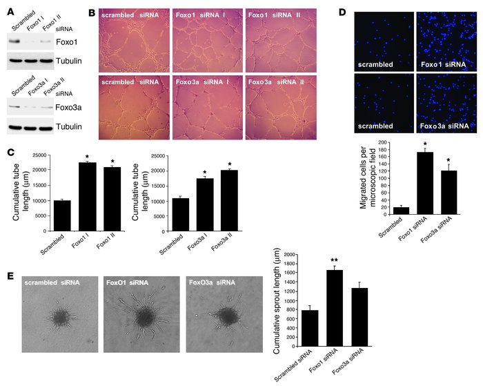 Silencing Foxo1 or Foxo3a activity enhances the angiogenic activity of e...